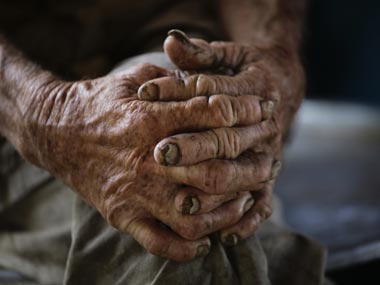 US scientists develop first 'home test' for Alzheimers US scientists develop first 'home test' for Alzheimers