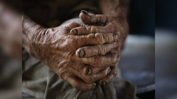 US scientists develop first 'home test' for Alzheimers