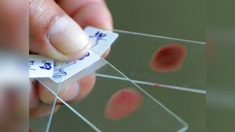 Novel blood test could predict if you'll die in next five years 