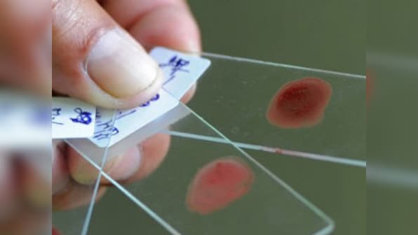 Novel blood test could predict if you'll die in next five years 