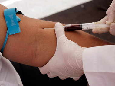 Tax tips: Did you know a blood test can give you a deduction benefit? Tax tips: Did you know a blood test can give you a deduction benefit?