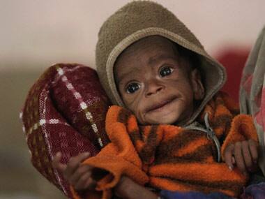 A four-member team of IIT researchers prepared the formulation in their food chemistry and technology lab which could be used as part of medical nutrition therapy for management of severe acute malnutrition children. Reuters 