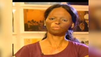 Acid attack victim Laxmi to receive International Women of Courage Award