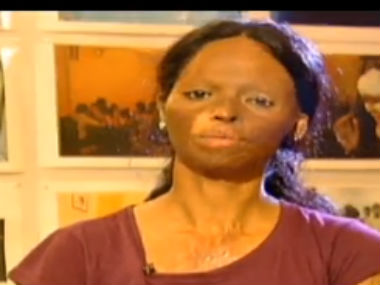 Acid attack victim Laxmi to receive International Women of Courage Award Acid attack victim Laxmi to receive International Women of Courage Award