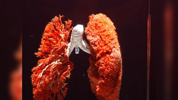 Finding it hard to breathe? Get screened for chronic obstructive pulmonary disease, say doctors