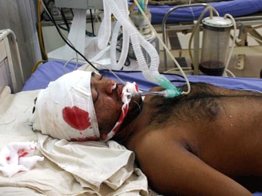 An injured polio worker in Pakistan. Representational image. Agencies.