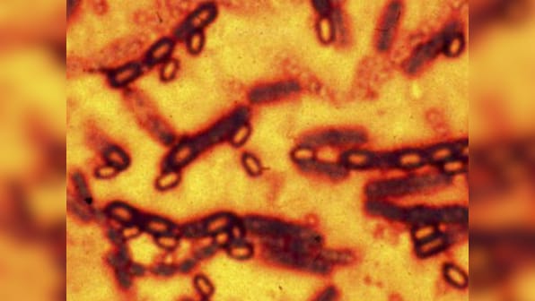 Close to 75 scientists, staff in US govt labs exposed to anthrax: report