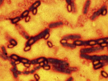 Close to 75 scientists, staff in US govt labs exposed to anthrax: report Close to 75 scientists, staff in US govt labs exposed to anthrax: report