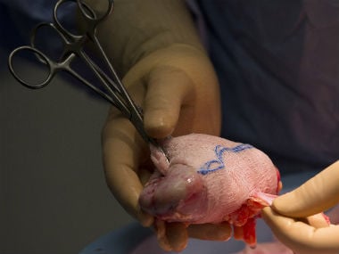 New supercooling technique offers breakthrough in organ transplants