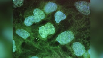 Scientists reduce degeneration in mice with motor neurone disease