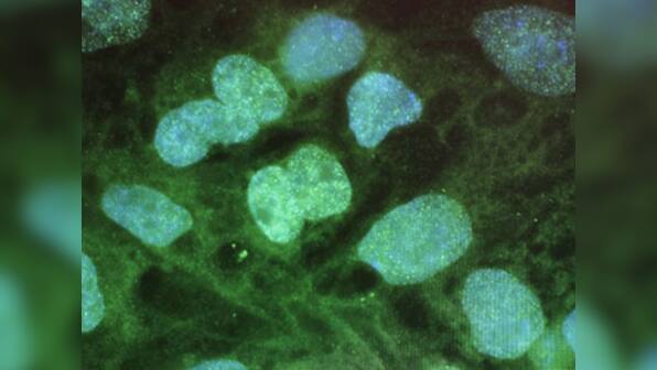 Scientists reduce degeneration in mice with motor neurone disease