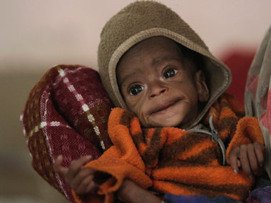 Two million children under five die in central, west Africa each year: UN Two million children under five die in central, west Africa each year: UN