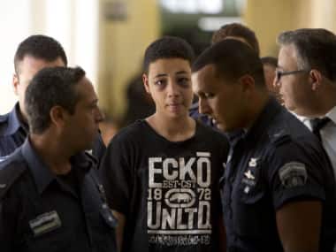 Tariq Abu Khdeir, 15, a U.S. citizen who relatives say was beaten and arrested by Israeli police during clashes sparked by the killing of his cousin Mohammed Abu Khdeir. AP 