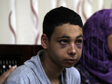 Mistreatment of young Palestinians fuels rage in east Jerusalem Mistreatment of young Palestinians fuels rage in east Jerusalem