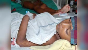 Encephalitis toll rises to 105 in West Bengal