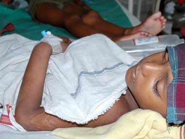 Encephalitis toll rises to 105 in West Bengal Encephalitis toll rises to 105 in West Bengal