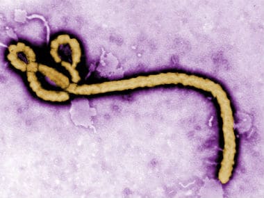 Indian government says so far there have been no case of Ebola virus in India. Reuters