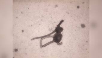 Drug for Ebola-like virus shows promising start in monkeys 