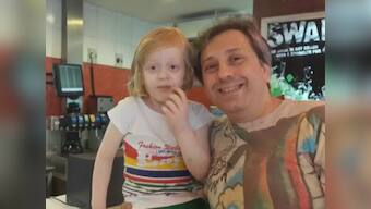 'Scary looking' child suffering from albinism denied entry into mall