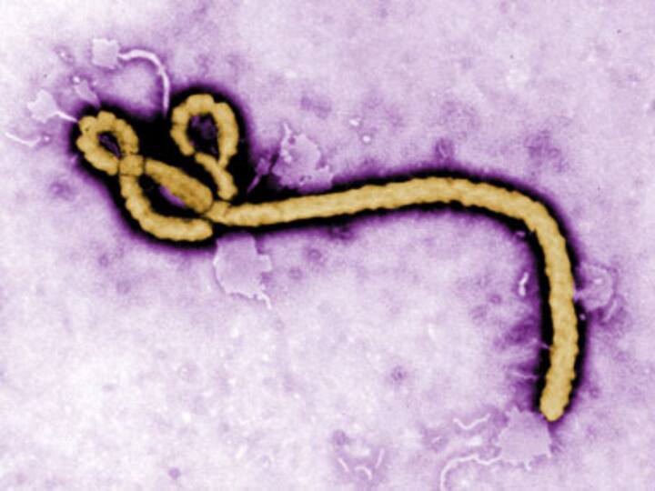Liberian doctor given experimental Ebola drug ZMapp dies
