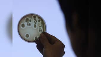 Anti-biotic resistant bacteria found in Aligarh hospital sewage