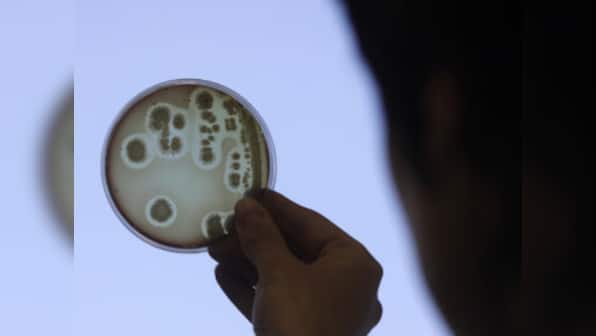 Anti-biotic resistant bacteria found in Aligarh hospital sewage