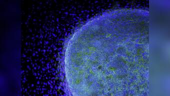 Lab-generated stem cells set for first human trial in Japan
