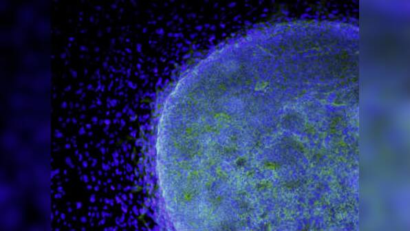 Lab-generated stem cells set for first human trial in Japan