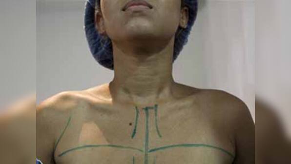 Venezuelan women frustrated with shortage in breast implants