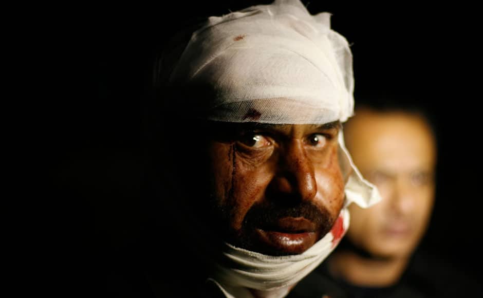 A Pakistani man wounded in a suicide bomb attack, reacts to the camera after received first aid in hospital in Wagah border, near Lahore November 2, 2014. At least 45 people were killed on Sunday when a suicide bomber blew himself up on the Pakistani-Indian border, police said, just after a daily ceremony when troops from both sides simultaneously lower the two nations' flags. REUTERS