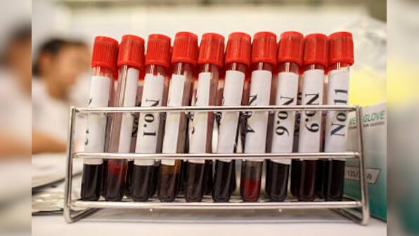 Guinea: Bandits steal blood samples that may be infected with Ebola