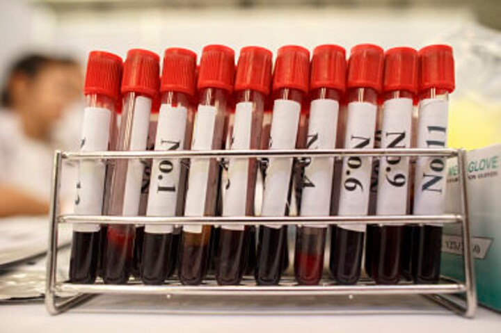 Guinea: Bandits steal blood samples that may be infected with Ebola