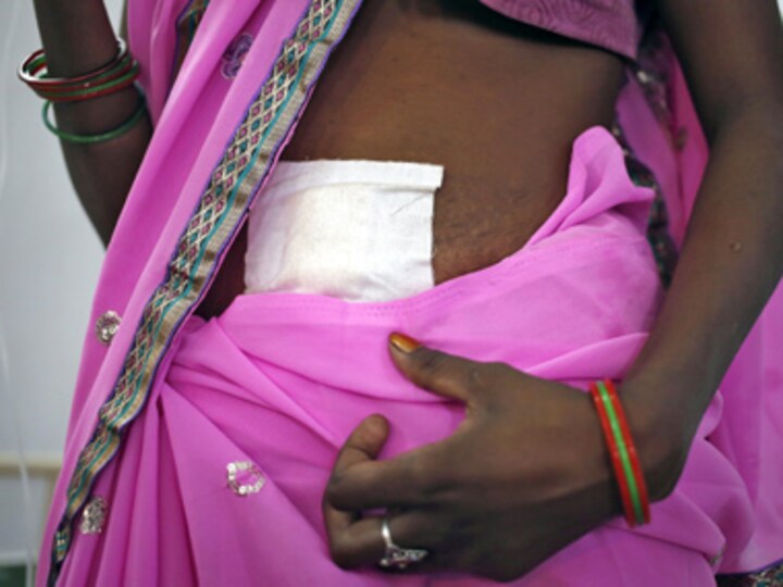 Congress demands CBI probe into botched sterilisations in Chhattisgarh