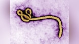 Glaxo's experimental Ebola vaccine passes early safety test