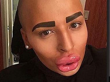 Man shells out $150,000 on plastic surgery to look like Kim Kardashian ...