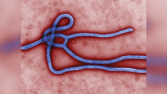 US soldier self monitoring for Ebola, dies in Texas