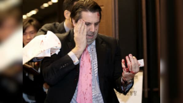 Knifed US envoy to South Korea in pain as officials investigate attacker's office