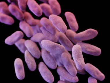 Second Los Angeles hospital issues alert over 'superbug', may have infected 70 patients Second Los Angeles hospital issues alert over 'superbug', may have infected 70 patients