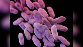 Second Los Angeles hospital issues alert over 'superbug', may have infected 70 patients 