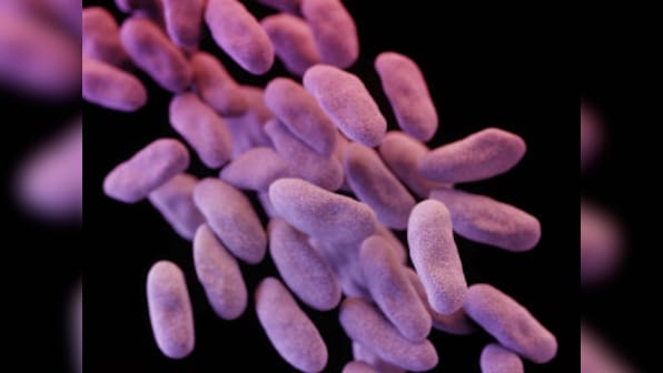 Second Los Angeles hospital issues alert over 'superbug', may have infected 70 patients 