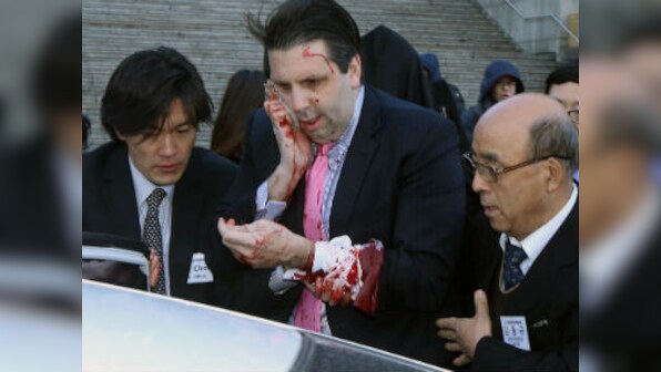 US envoy to South Korea in stable condition after knife attack 
