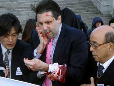 Knifed US envoy Mark Lippert to be released from hospital today Knifed US envoy Mark Lippert to be released from hospital today