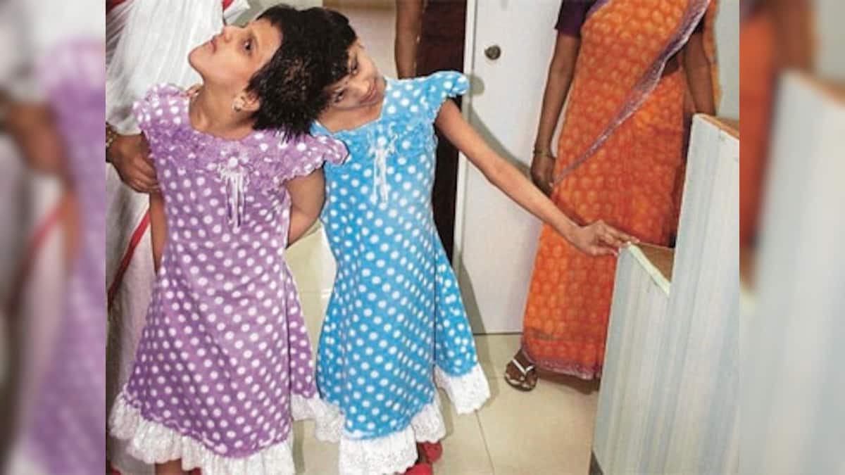 12 years on, conjoined twins Veena and Vani find hope of happy