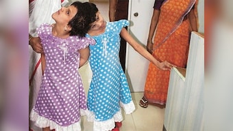 12 years on, conjoined twins Veena and Vani find hope of happy separation