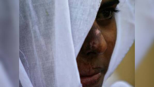 186 of 310 acid attack cases in Uttar Pradesh in 2014: Govt tells Lok Sabha