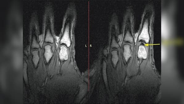 Revealed: Here's what really happens when you crack your knuckles