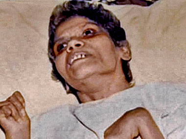 KEM hospital staff want Room No. 4 to be turned into Aruna Shanbaug memorial KEM hospital staff want Room No. 4 to be turned into Aruna Shanbaug memorial