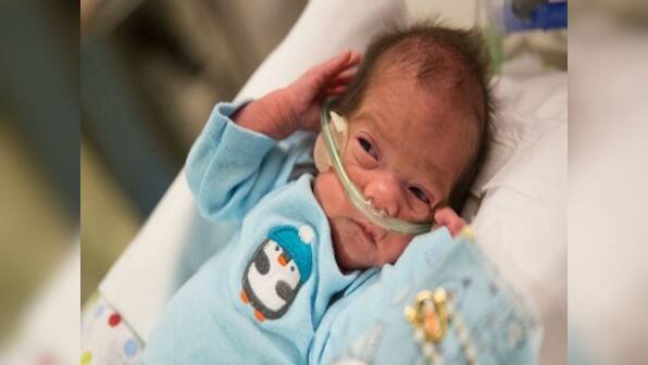 A giant leap of faith: Brain dead, pregnant mother kept alive for 54 days for delivery