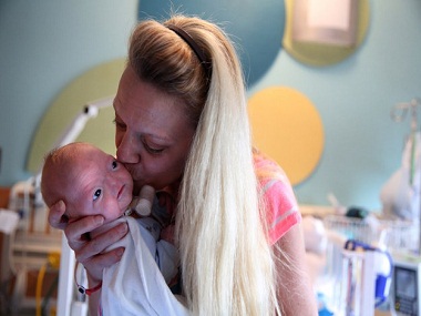 This Alabama baby born without a nose is adorable This Alabama baby born without a nose is adorable