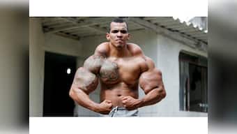 Man injects oil and alcohol in muscles to look like the Hulk, almost loses his arms